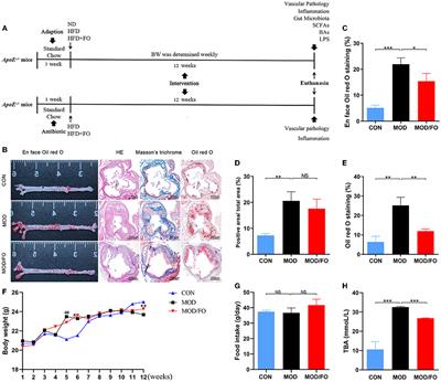 Dietary α-Linolenic Acid-Rich Flaxseed Oil Ameliorates High-Fat Diet-Induced Atherosclerosis via Gut Microbiota-Inflammation-Artery Axis in ApoE−/− Mice